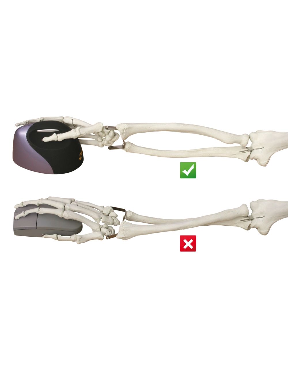 Evoluent VerticalMouse 4 Sinistro